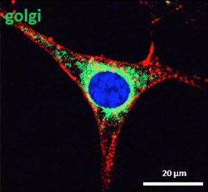 golgi-Zellenbild-web